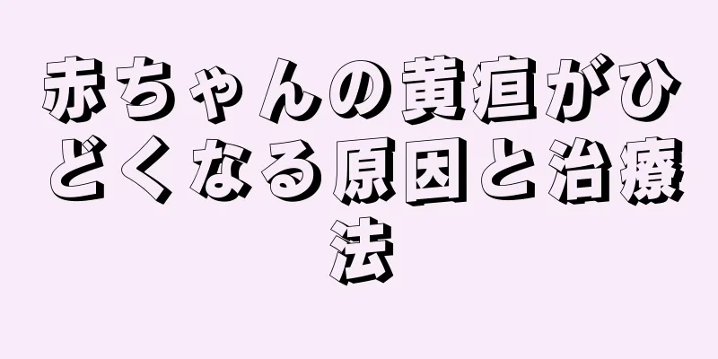 赤ちゃんの黄疸がひどくなる原因と治療法