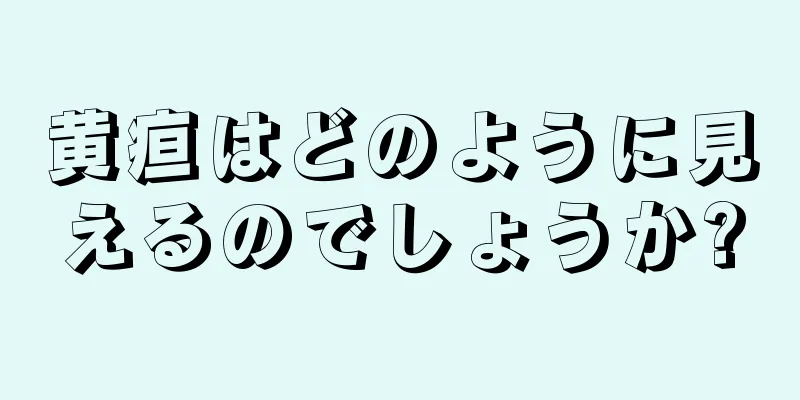 黄疸はどのように見えるのでしょうか?