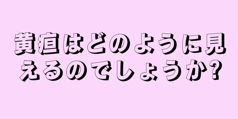 黄疸はどのように見えるのでしょうか?