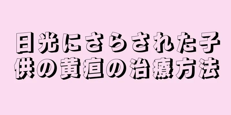 日光にさらされた子供の黄疸の治療方法